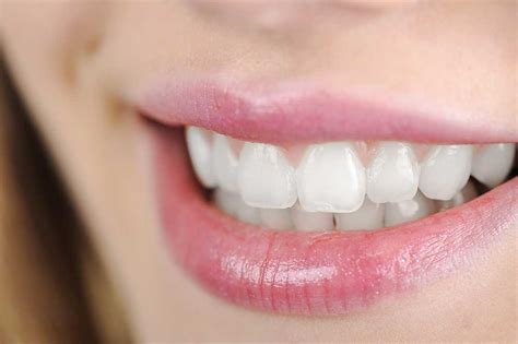 Teeth Whitening Near Me | Professional Teeth Whitening Dentist Katy TX