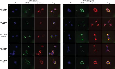 Effect Of Chloroquine Addition On Pna Cytoplasmic Distribution Live