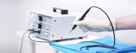 Diatermocoagulazione – NIKE Medical Center