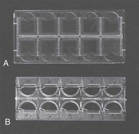 Routine Urinalysisthe Microscopic Exam Of Urine Sediment