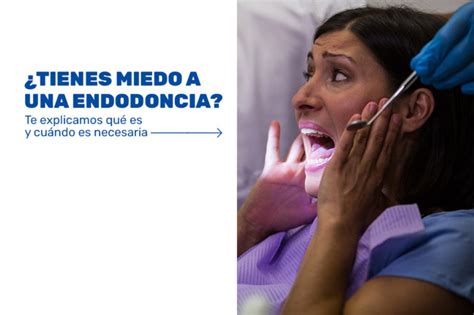 Tienes Miedo A Una Endodoncia Te Explicamos Qu Es Y Cu Ndo Es