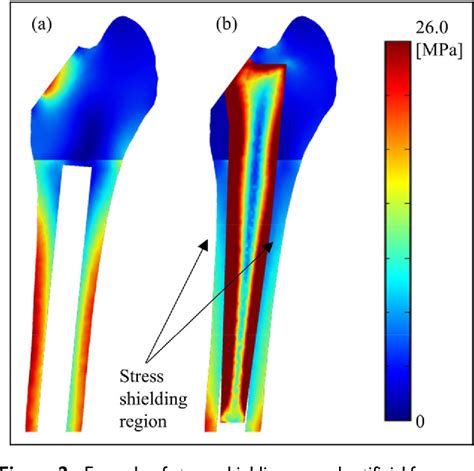 Figure 2 From Design Optimization Of Functionally Graded Lattice Infill