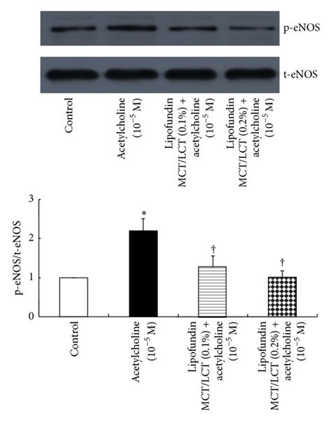 Effect Of Lipofundin MCT LCT 0 1 And 0 2 N 6 On The Phosphorylation