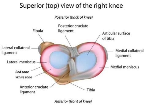 Meniscus Tear Symptoms And Recovery Infographic Artofit