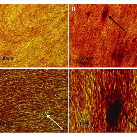 Isolation Of Stem Cells From The Apical Papilla Showing A