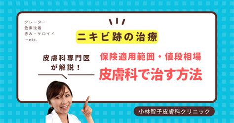 ニキビ跡の治療｜こばとも皮膚科｜栄駅（名古屋市栄区）徒歩2分