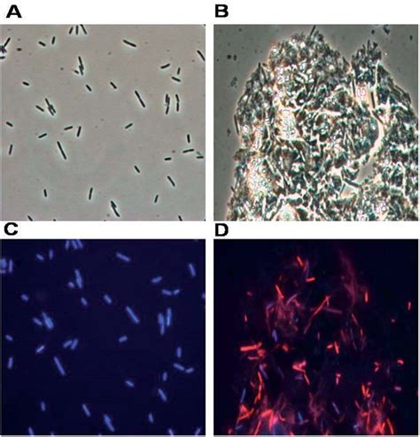 E Coli Microscope Microscope E Coli Stool Micropedia