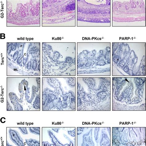 Effect Of Ku86 Dna Pkcs Or Parp 1 Deficiency On Morphology Download Scientific Diagram