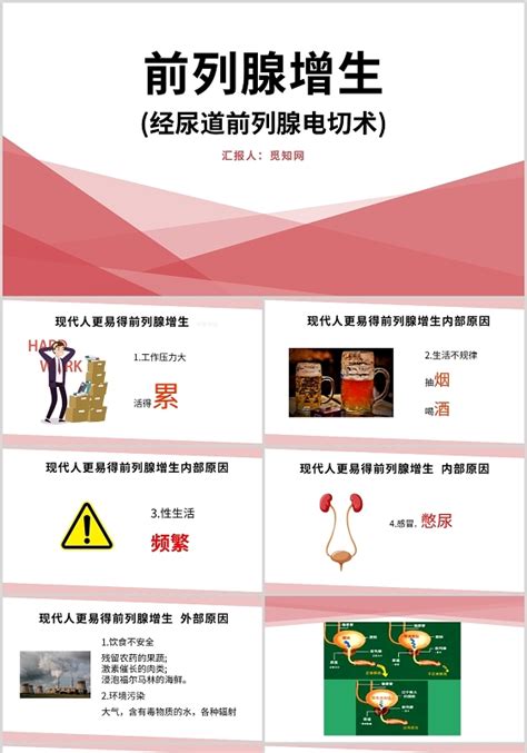 前列腺ppt 前列腺ppt模板下载 觅知网