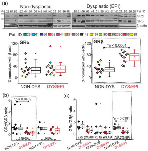 Ijms Free Full Text Glucocorticoid Receptor β Isoform Predominates