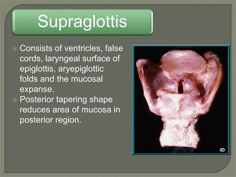 Ct Of The Larynx Ppt