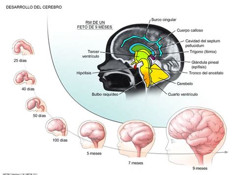 Pin On Cerebro