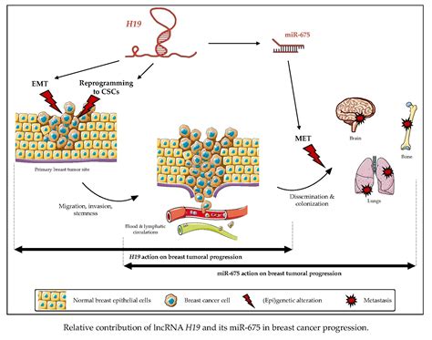 Cancers Free Full Text Enhancement Of Breast Cancer Cell