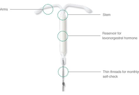 Mirena® Iud Up Close Mirena® Iud