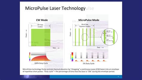 MicroPulse Laser Therapy In The Management Of DME YouTube