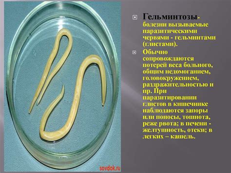 Глистные заболевания (гельминтозы) - online presentation