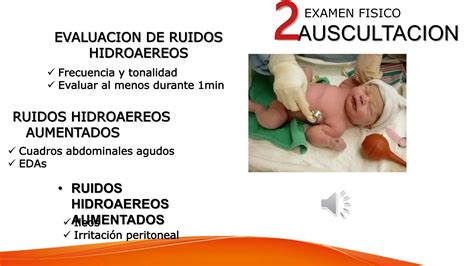 Semiologia Abdominal Del Paciente Pedi Trico Pptx Ppt