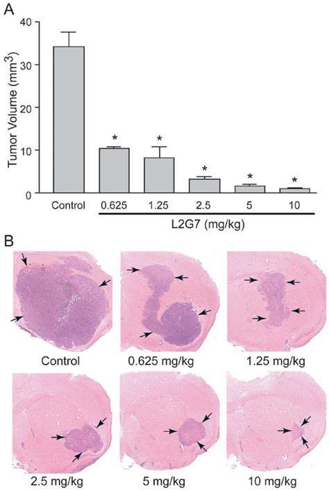 Systemic Anti Hgf Mab Inhibits Growth Of Orthotopic Pten Null Egfrviii