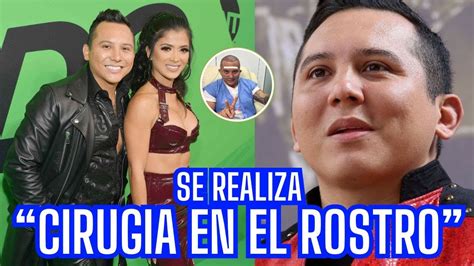 Las CIRUG AS De Las Cueles Edwin Luna Es Criticado En Redes YouTube