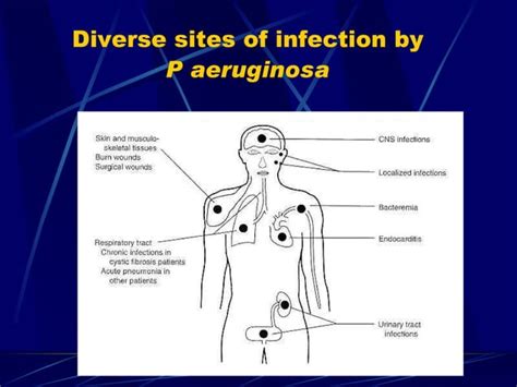 Campylobacter | PPT