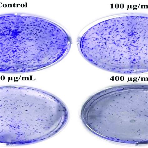 Gc Ms Chromatogram Of The Ethanolic Extract Of Artemisia Vulgaris