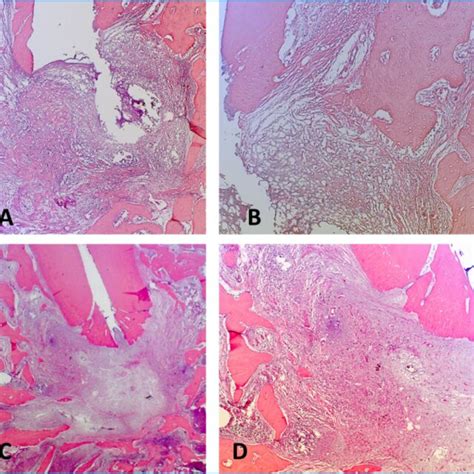 Photomicrographs Of Representative He Stained Microscopic Sections Of