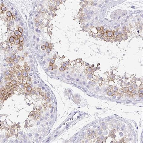 Pten2 Polyclonal Antibody Invitrogen 100 μl Unconjugatedanticuerpos