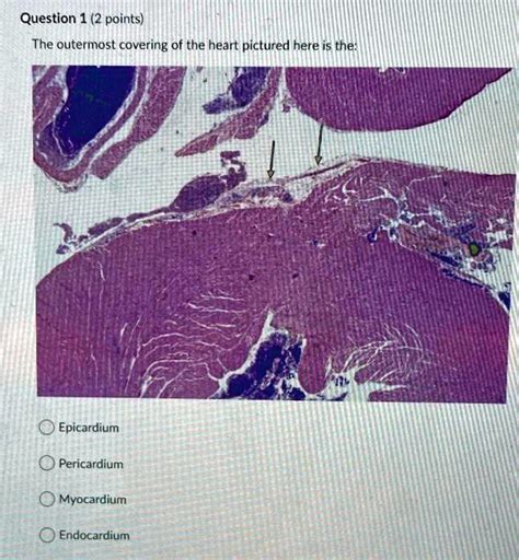 SOLVED Question 1 2 Points The Outermost Covering Of The Heart