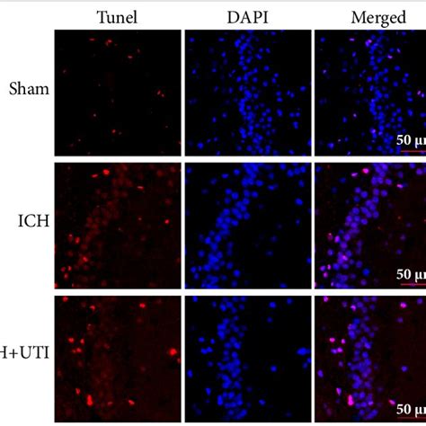 UTI Alleviates Neuronal Apoptosis After ICH TUNEL Staining Showed