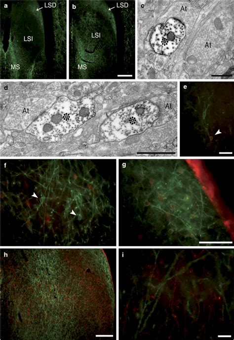 Cellular And Subcellular Localization Of Nk1rs In The Septum And