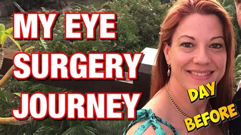 Blepharoplasty Day Before Surgery 😍 Youtube