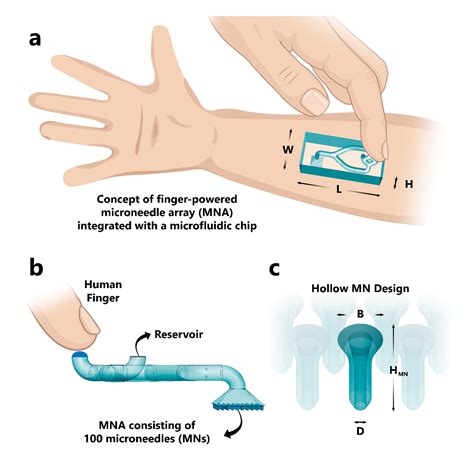 Applied Sciences Free Full Text Finger Actuated Microneedle Array