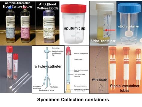 Diagnostic Medical Microbiology Traditional And Modern Approach