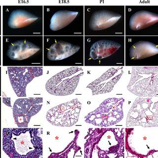 Developmental abnormalities following ectopic activation of canonical ... 