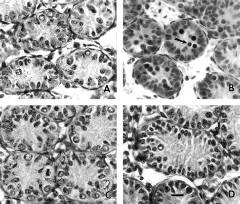 Representative Light Micrographs Of Testicular Sections From 7 Day Old