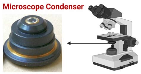 Microscope Condenser: Structure, Types, Functions