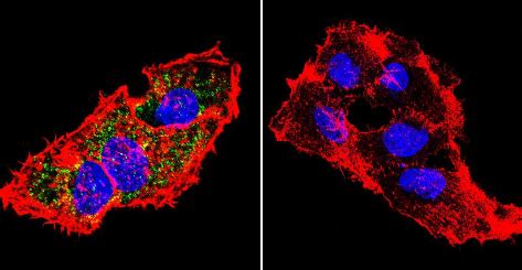 Anti Prolactin Receptor PRL R Antibody U5 Ab2772 Abcam