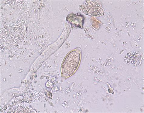 Trichuris Trichiura Medical Laboratories