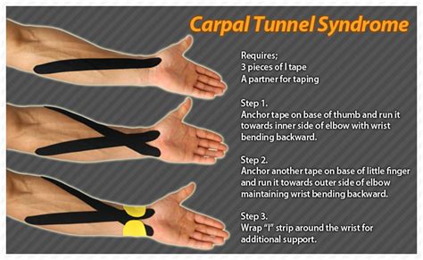 Aresports Carpal Tunnel Carpal Tunnel Exercises Kinesiology Taping