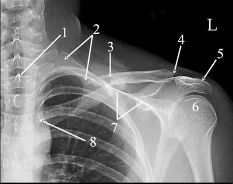 AP Clavicle Diagram Quizlet