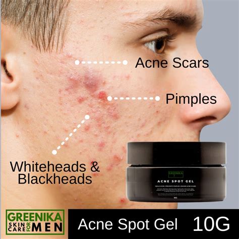 Greenika For Men Acne Spot Gel Anti Acne Pimple Treatment Shopee