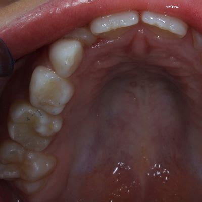 Casos Clínicos Clínica Ariaga A sua Clínica Dentária na Madeira