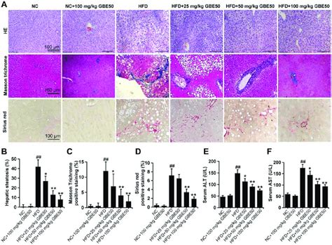 Gbe50 Ameliorated Hfd Induced Liver Injury A D Representative Liver