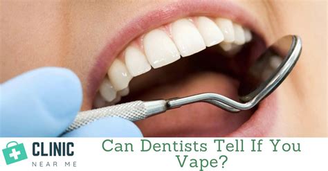 Can Dentists Tell If You Vape? When Should You Worry? - Clinic Near Me