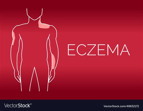 Red eczema background design Royalty Free Vector Image