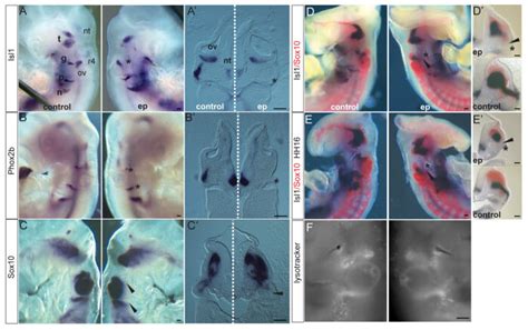 Placode Ablation Affects Neural Crest Corridor Formation A C