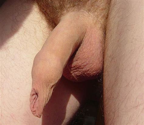 Porno Long Foreskin Overhang Telegraph