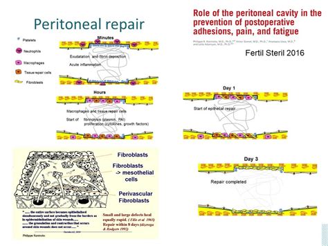 Prevention of postoperative adhesions - gynsurgery.org