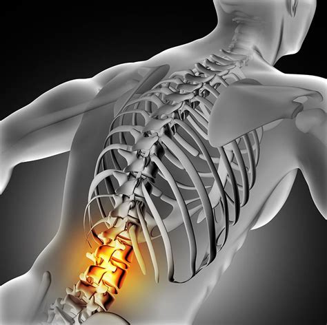 L4 L5 spine pain | DISC Spine Institute TX