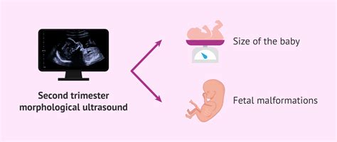 Morphologic ultrasound in the 19th week of pregnancy